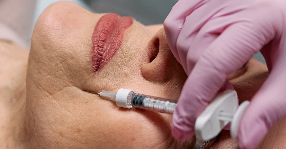 How to Manage Side Effects of Botox