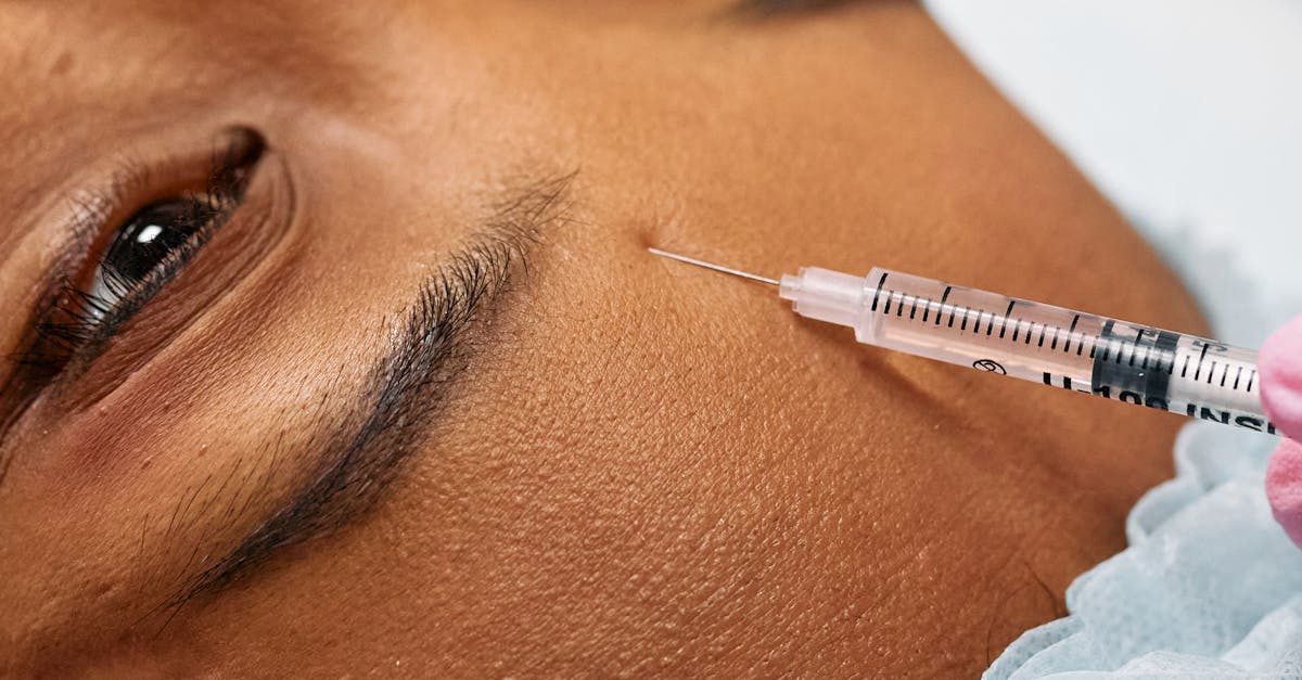 Roundup of Expert Tips on Botox Maintenance