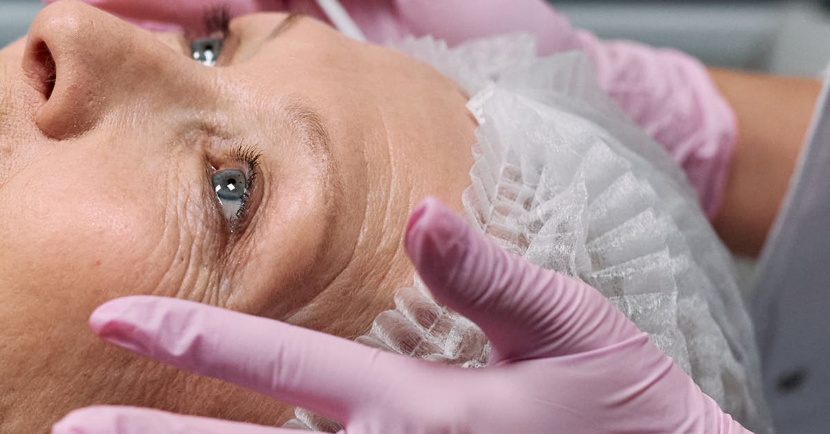 What to Expect During Botox Recovery